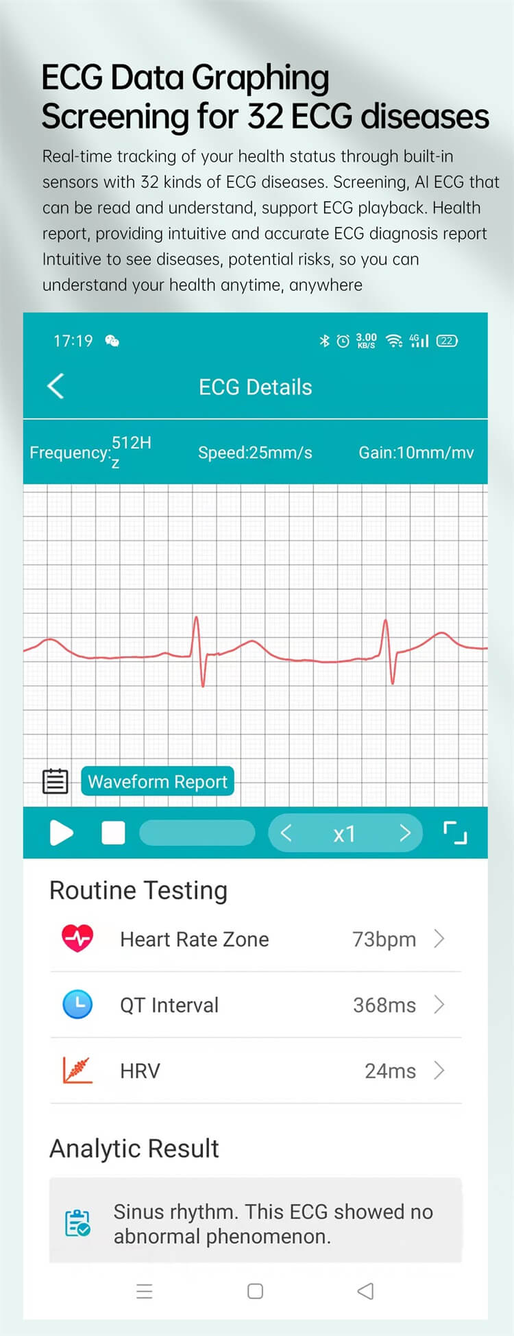 E400 intelligens EKG vércukorszint egészségügyi óra, 1,39 hüvelykes HD képernyős EKG mellkasi tapasz valós idejű EKG-elemzés Smart Watch-Shenzhen Shengye Technology Co., Ltd.