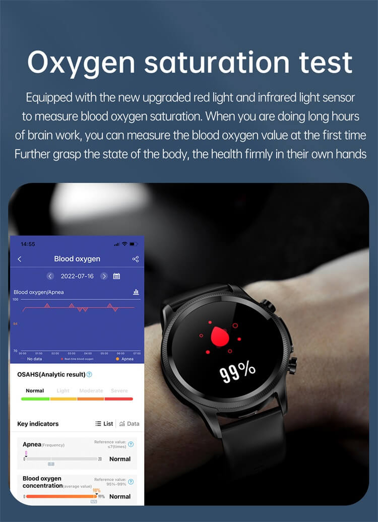 E400 ECG Inteligente Glicose no Sangue Relógio de Saúde Tela HD de 1,39 Polegadas ECG Remendo no Peito em Tempo Real Análise de ECG Relógio Inteligente-Shenzhen Shengye Technology Co.,Ltd