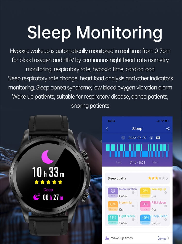 E400 Intelligent ECG Blood Glucose Health Watch 1,39 pouces HD Screen ECG Chest Patch Analyse ECG en temps réel Smart Watch-Shenzhen Shengye Technology Co., Ltd