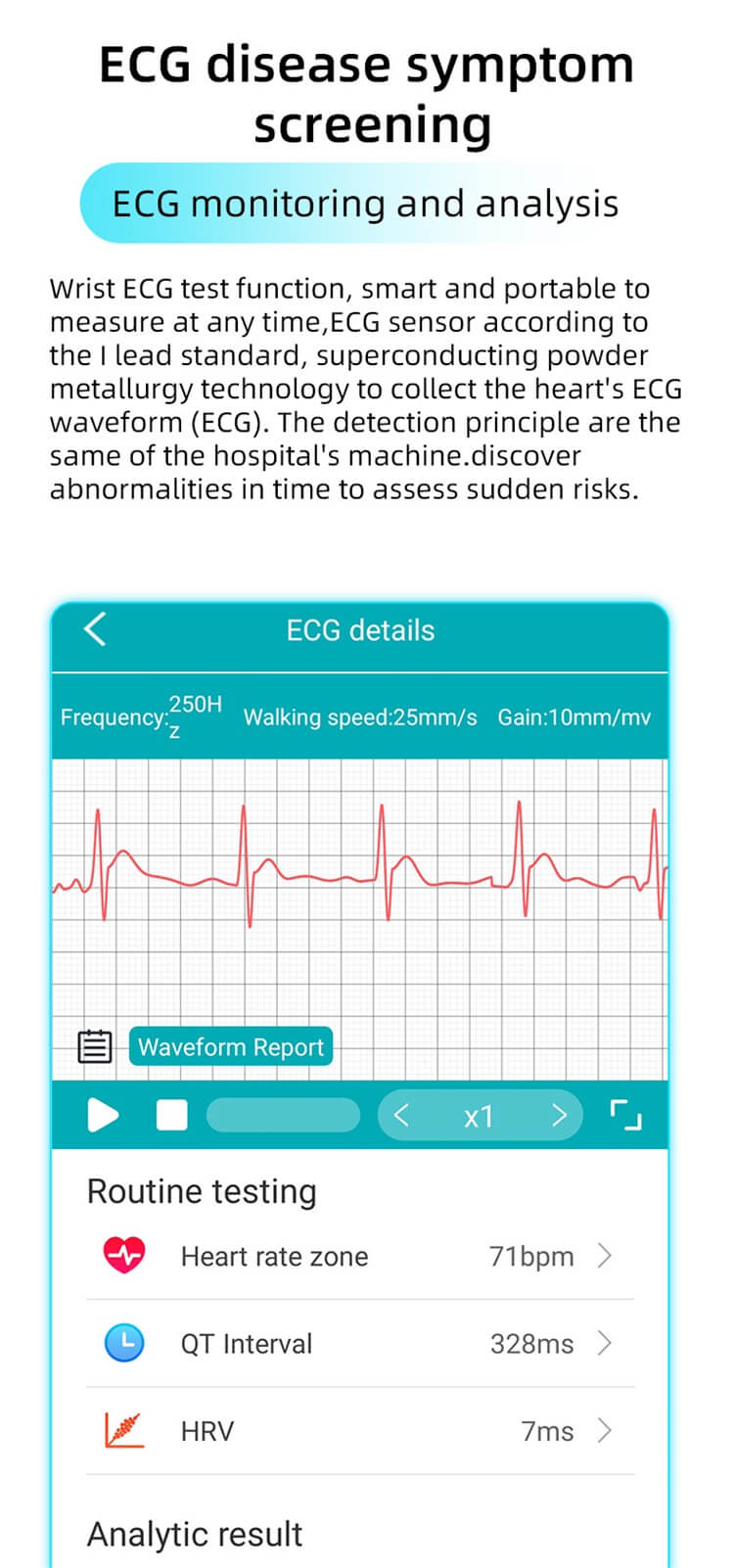 EP01 ECG HRV Blood Glucose Blood Pressure Smart Watch-Shenzhen Shengye Technology Co.,Ltd