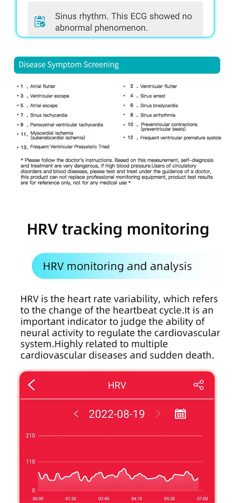 EP01 EKG HRV Vércukor Vérnyomás Smart Watch-Shenzhen Shengye Technology Co., Ltd.