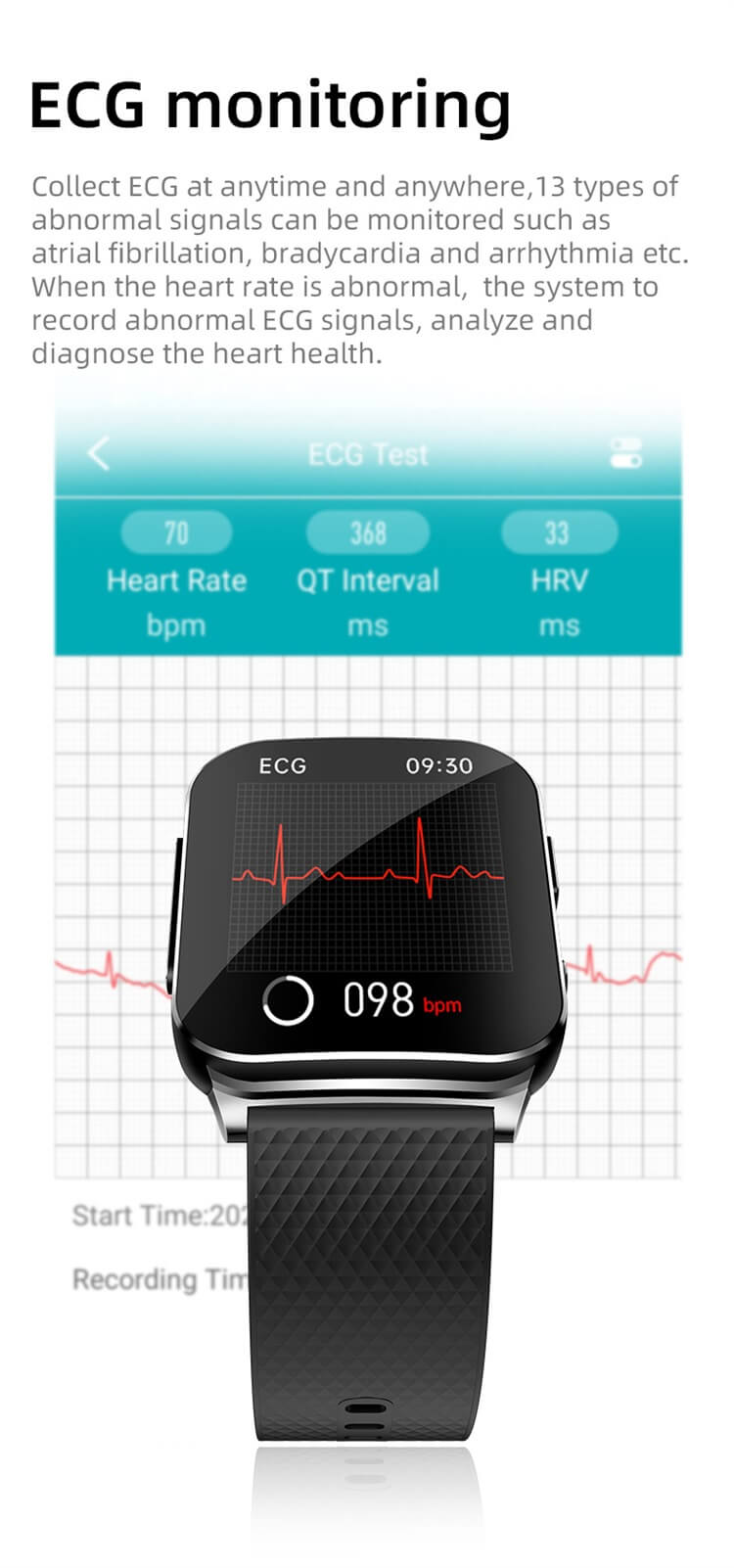 EP03 ECG PTT Blood Glucose Heart Rate Blood Pressure Body Temperature Blood Oxygen 24 Hours Dynamic Smart Watch-Shenzhen Shengye Technology Co.,Ltd