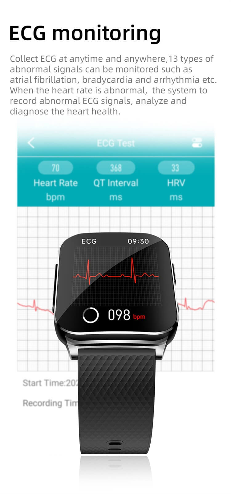 EP03 ECG PTT Glicemia Frequenza cardiaca Pressione sanguigna Temperatura corporea Ossigeno nel sangue 24 ore Dynamic Smart Watch-Shenzhen Shengye Technology Co.,Ltd