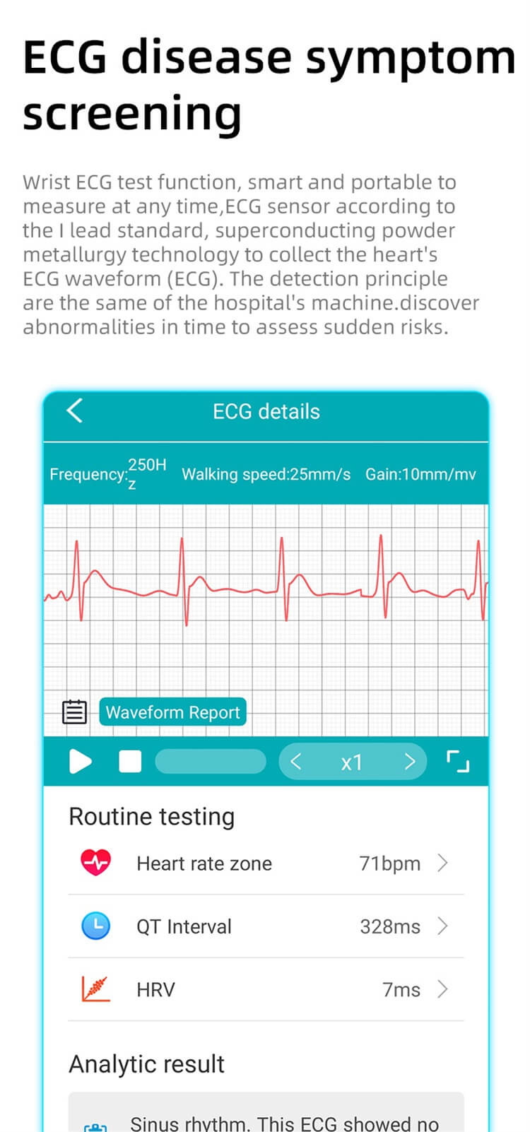 EP03 ECG PTT Glycémie Fréquence cardiaque Pression artérielle Température corporelle Oxygène sanguin 24 heures Montre intelligente dynamique-Shenzhen Shengye Technology Co., Ltd