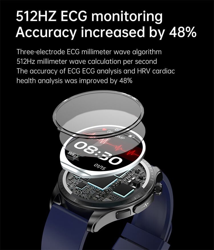 E420 ECG AFE Monitoring 1.39 Inch IPS HD Large Screen Smart Watch-Shenzhen Shengye Technology Co.,Ltd