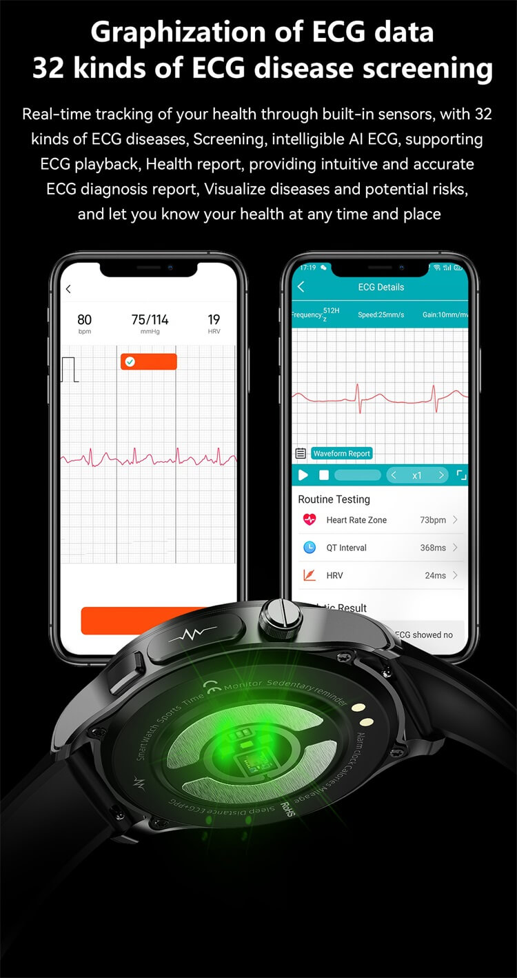 E420 EKG AFE-Überwachung 1,39 Zoll IPS HD Großbild-Smartwatch-Shenzhen Shengye Technology Co.,Ltd