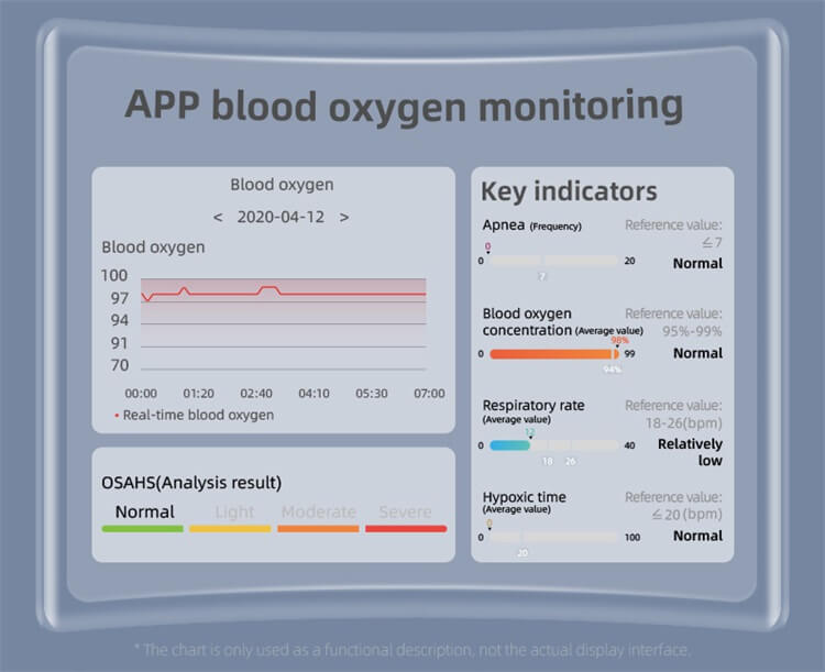 EP08 Smart Watch ECG Disease Symptom Screen-Shenzhen Shengye Technology Co.,Ltd