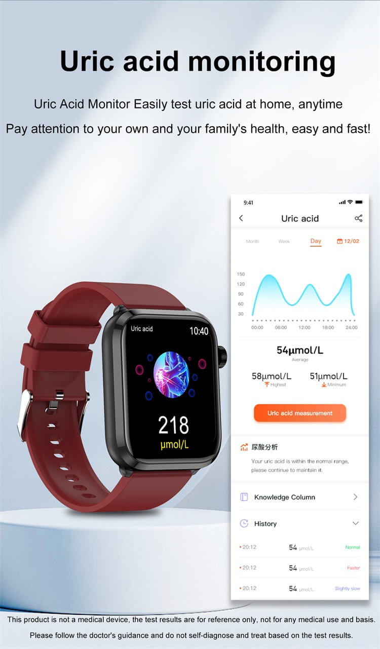 ET210 ECG Smart Watch Lipide Uric Acid Monitoring Al medische diagnose Ademhalingstraining-Shenzhen Shengye Technology Co., Ltd