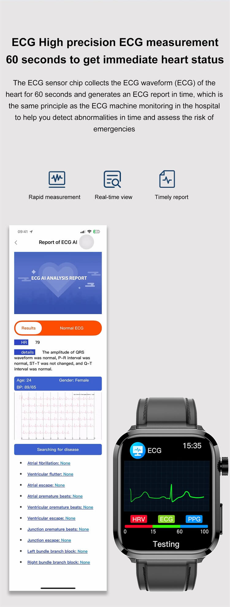 ET210 EKG okosóra Lipid húgysav monitorozás Al Orvosi Diagnosztika Légzéstréning – Shenzhen Shengye Technology Co., Ltd.