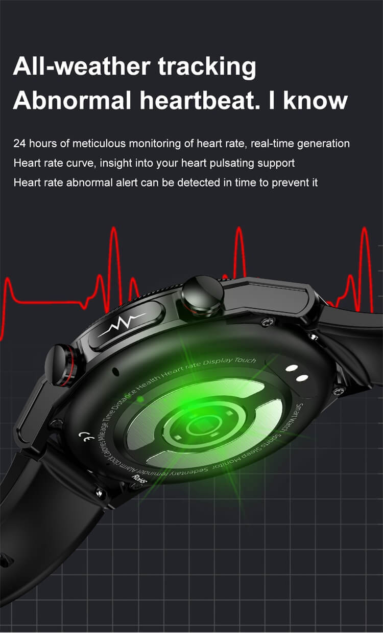 ET310 Smartwatch ECG function Lipid Uric Acid Measurement Temperature monitoring-Shenzhen Shengye Technology Co.,Ltd