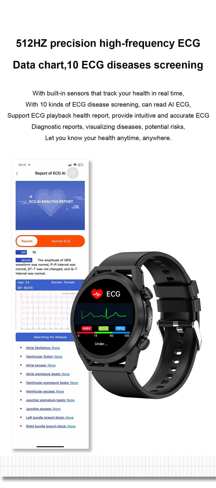 ET310 สมาร์ทวอทช์ ECG ฟังก์ชั่น การวัดอุณหภูมิกรดยูริกของไขมัน การตรวจสอบอุณหภูมิ-Shenzhen Shengye Technology Co.,Ltd