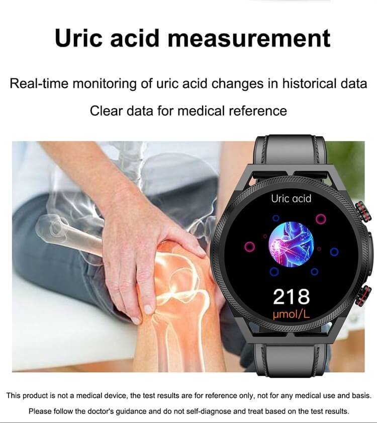 ET310 สมาร์ทวอทช์ ECG ฟังก์ชั่น การวัดอุณหภูมิกรดยูริกของไขมัน การตรวจสอบอุณหภูมิ-Shenzhen Shengye Technology Co.,Ltd