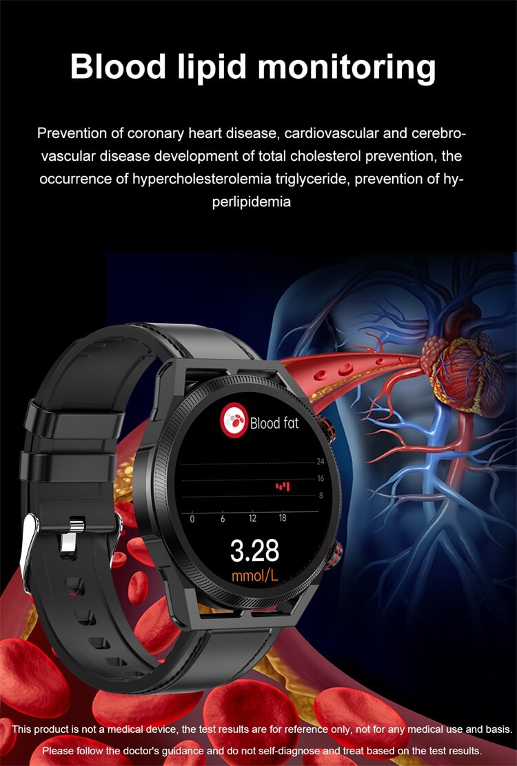 ET310 Smartwatch ECG function Lipid Uric Acid Measurement Temperature monitoring-Shenzhen Shengye Technology Co.,Ltd