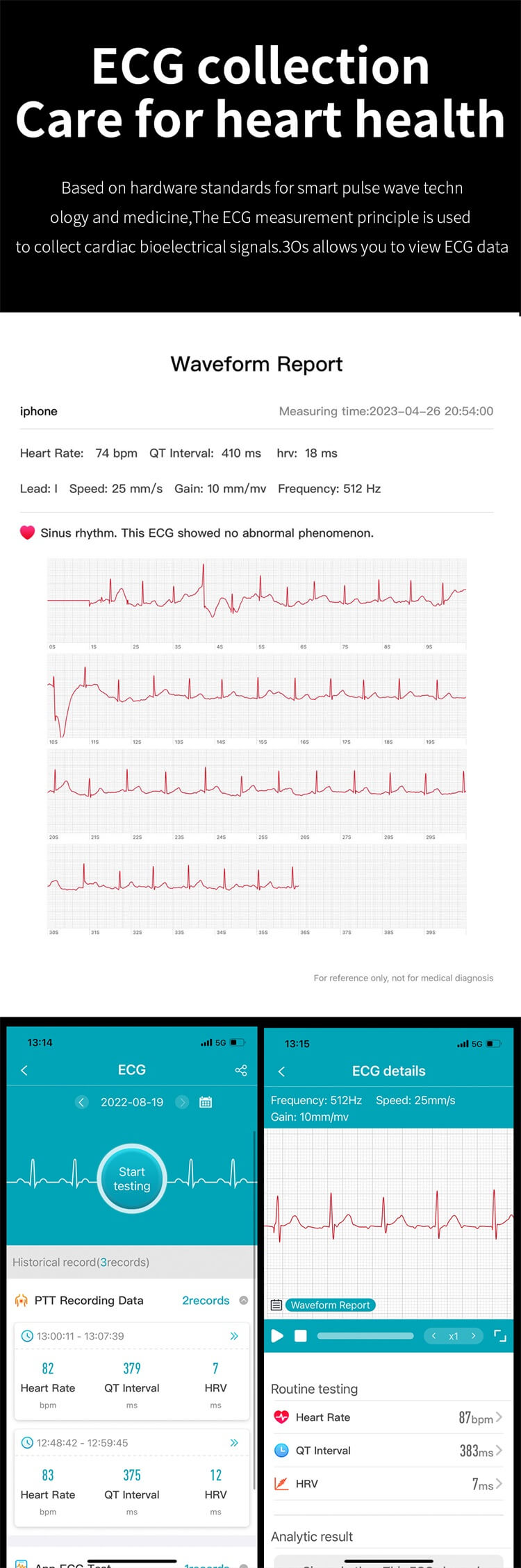 ET440 Akıllı Saat EKG Testi Kan Şekeri İzleme Met Fonksiyonu IP67 Su Geçirmez-Shenzhen Shengye Technology Co.,Ltd