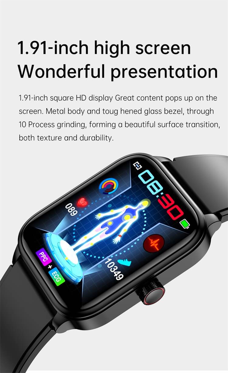 ET540 Smart Watch ECG + PPG HRV AI Diagnosi medica Controllo accessi NFC-Shenzhen Shengye Technology Co., Ltd