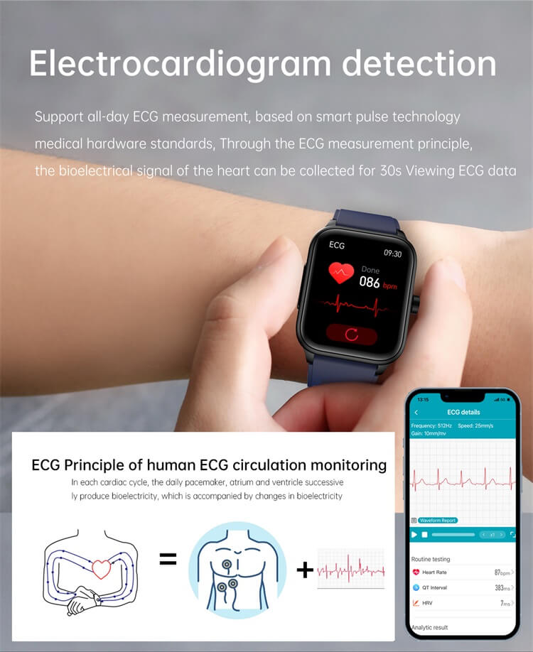 Умные часы ET540 ЭКГ + PPG HRV AI Медицинская диагностика NFC Контроль доступа-Shenzhen Shengye Technology Co.,Ltd