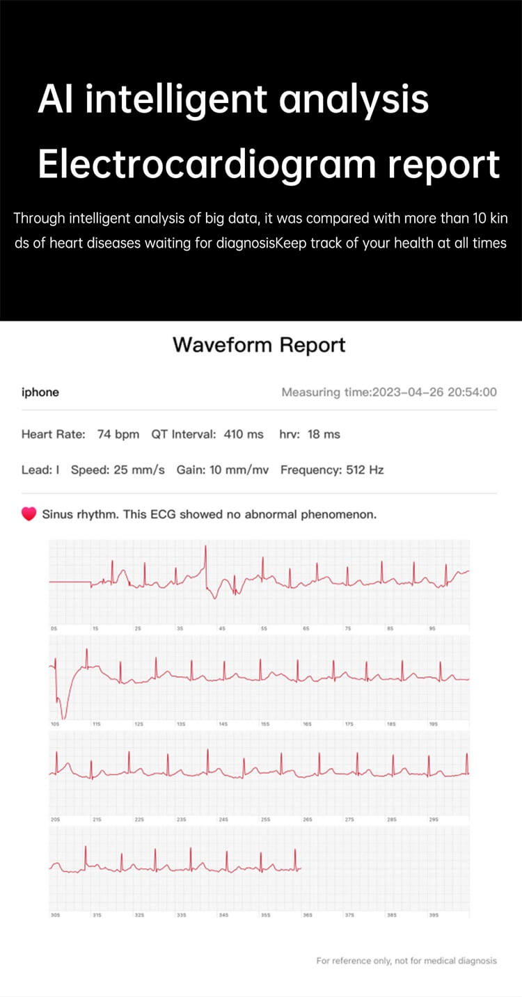 ET540 Smart Watch  ECG+PPG HRV AI Medical Diagnosis NFC Access Control-Shenzhen Shengye Technology Co.,Ltd