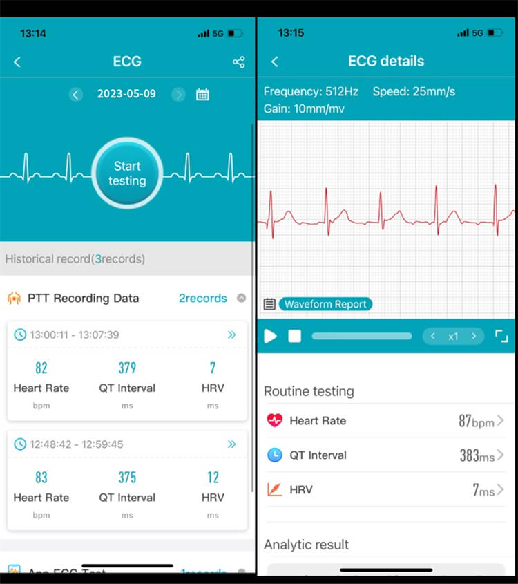 Умные часы ET540 ЭКГ + PPG HRV AI Медицинская диагностика NFC Контроль доступа-Shenzhen Shengye Technology Co.,Ltd