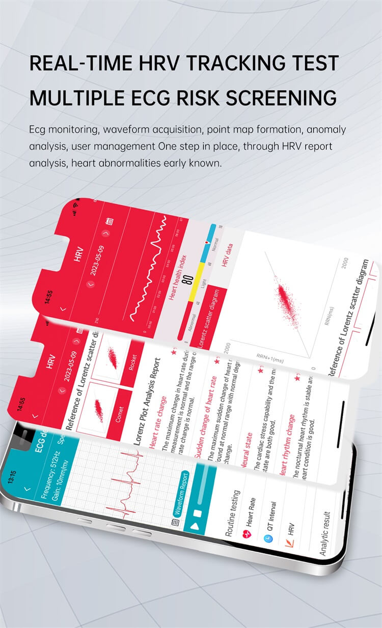 ET540 Smart Watch  ECG+PPG HRV AI Medical Diagnosis NFC Access Control-Shenzhen Shengye Technology Co.,Ltd