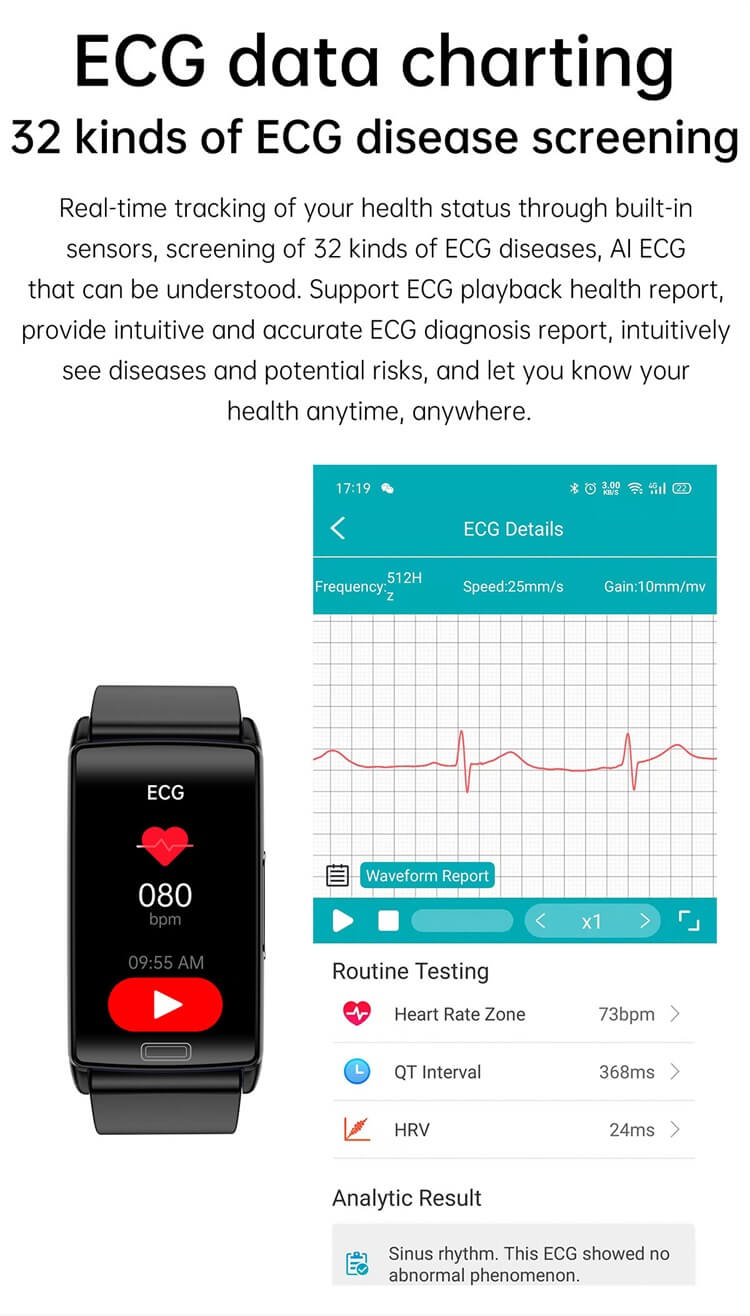 E610 Sağlık Smartwatch Kan Şekeri İzleme EKG Testi HRV Değişkenliği-Shenzhen Shengye Technology Co.,Ltd