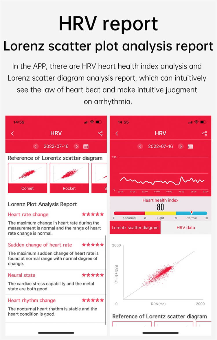 E610 Health Smartwatch Blood Glucose Monitoring ECG Test HRV Variability-Shenzhen Shengye Technology Co.,Ltd