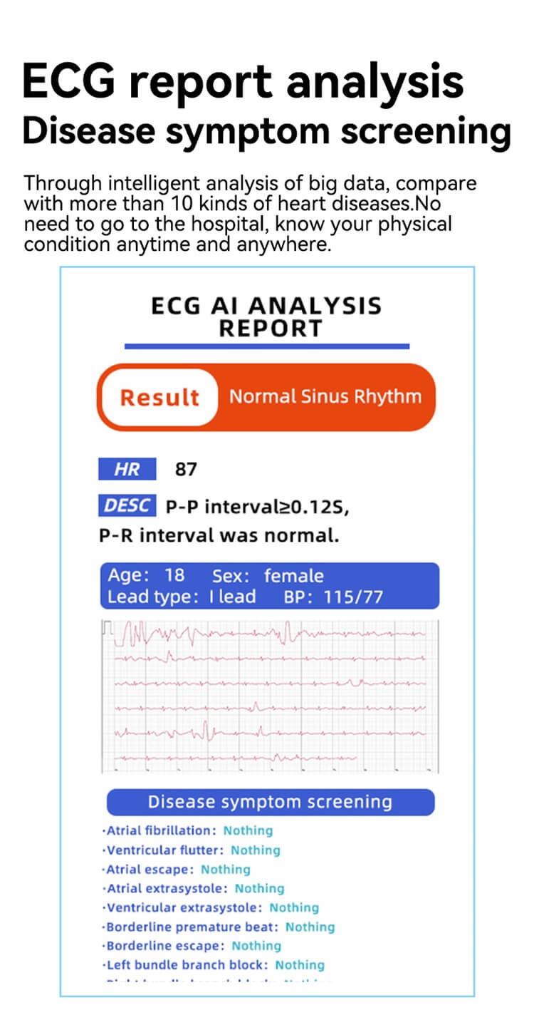 KS05 Smartwatch AI Voice Assistant ECG Test Blood Glucose Monitoring-Shenzhen Shengye Technology Co.,Ltd