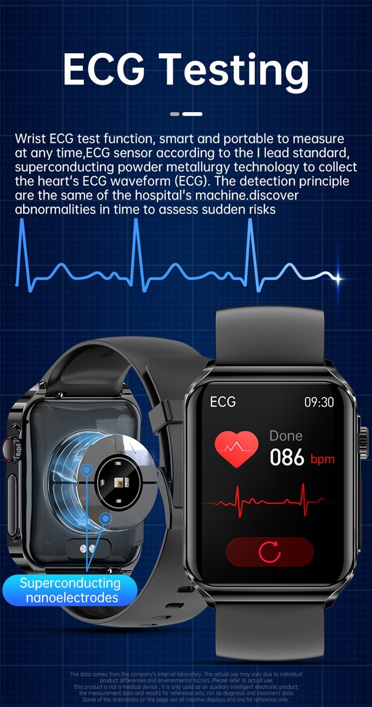 JL05 ECG Smartwatch ECG اختبار بيانات HRV NFC التحكم في الوصول تتبع دورة الإناث-Shenzhen Shengye Technology Co.,Ltd