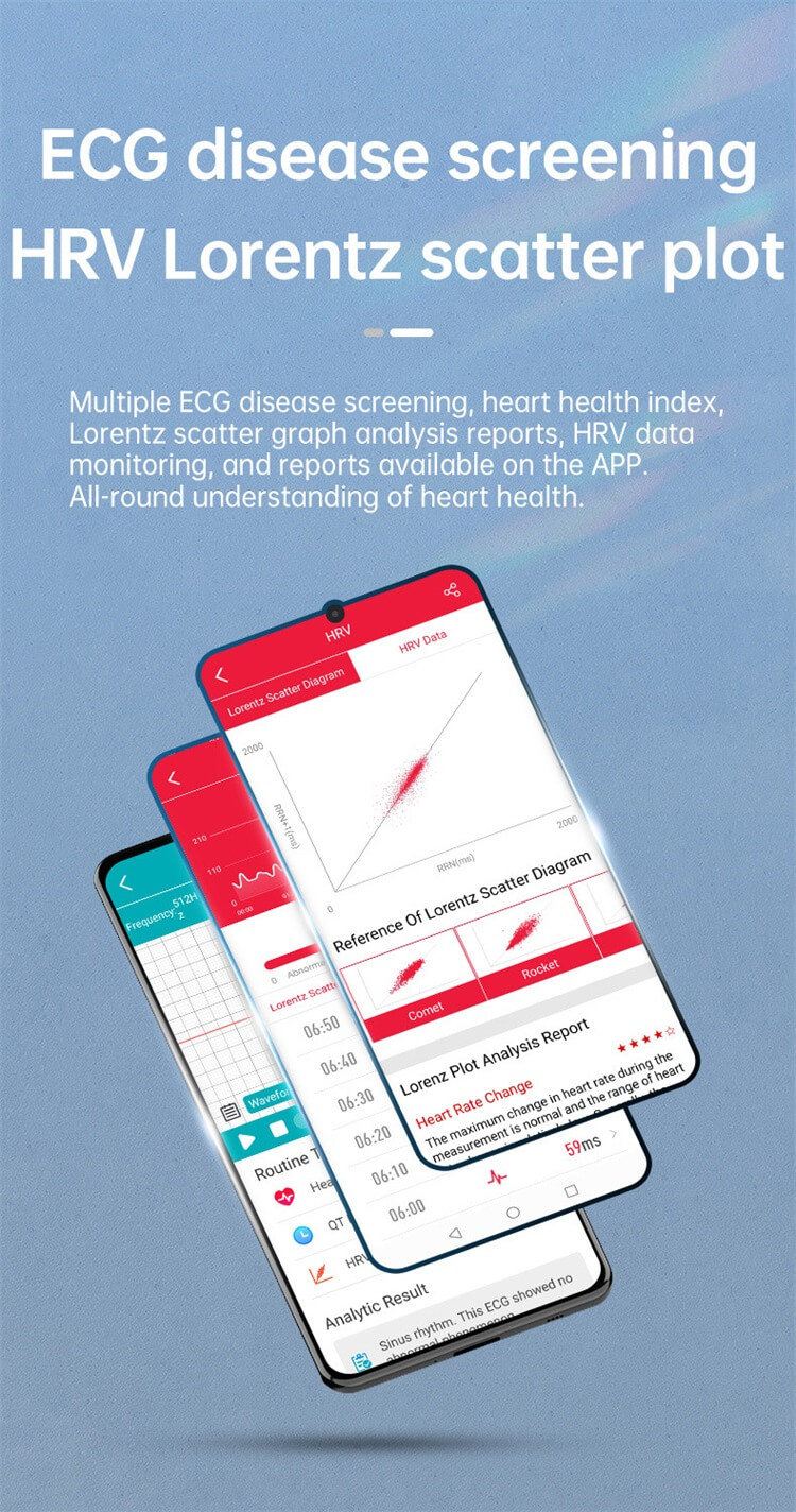 JL05 EKG okosóra EKG-teszt HRV adatok NFC hozzáférés-vezérlés női cikluskövetés-Shenzhen Shengye Technology Co., Ltd.