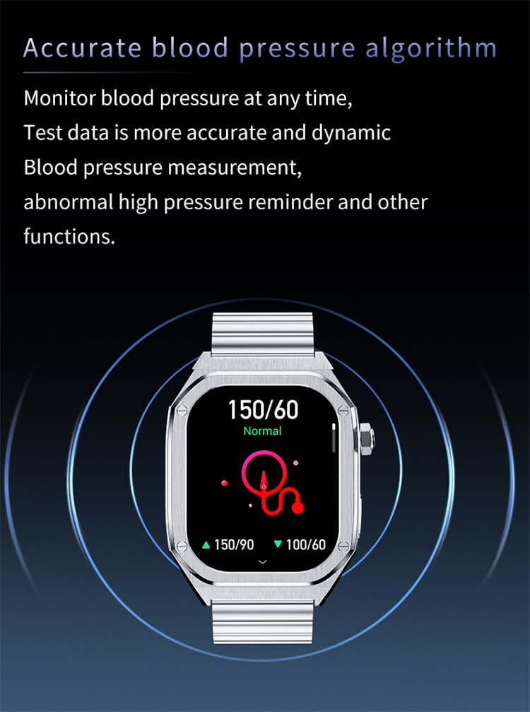 HD40 AMOLED Smartwatch EKG 400 mAh NFC Erişim Kontrolü-Shenzhen Shengye Technology Co.,Ltd