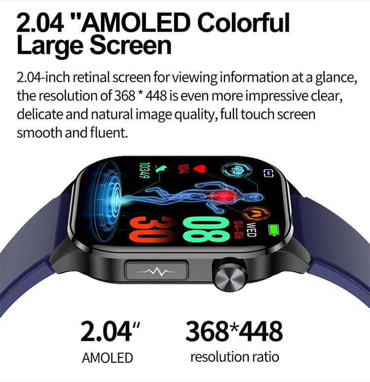 ET580 AMOLED स्मार्टवॉच ECG इलेक्ट्रोकार्डियोग्राम AI मेडिकल डायग्नोसिस IP68 वॉटरप्रूफ-शेन्ज़ेन शेंगये टेक्नोलॉजी कं, लिमिटेड