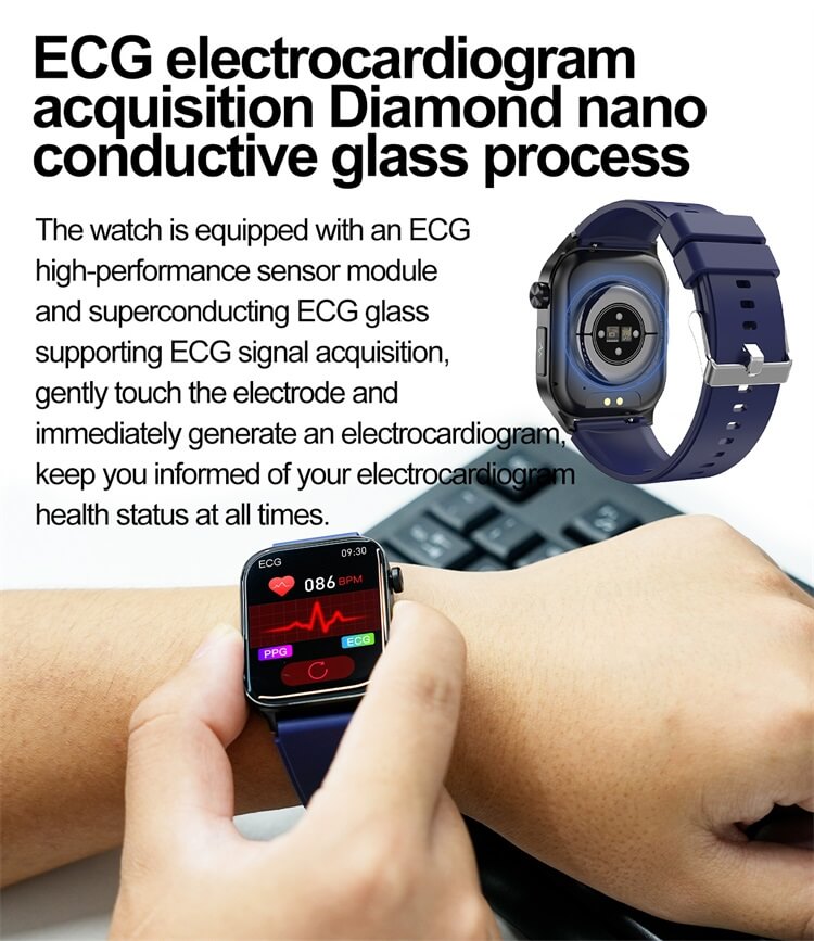 ET580 AMOLED Smartwatch ECG Elektrocardiogram AI Medische diagnose IP68 Waterdicht-Shenzhen Shengye Technology Co.,Ltd