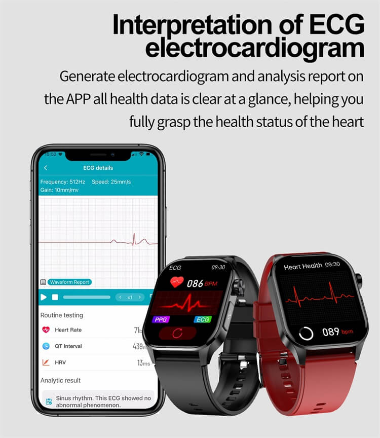 ET580 AMOLED Smartwatch ECG Elettrocardiogramma AI Diagnosi medica IP68 Impermeabile-Shenzhen Shengye Technology Co., Ltd