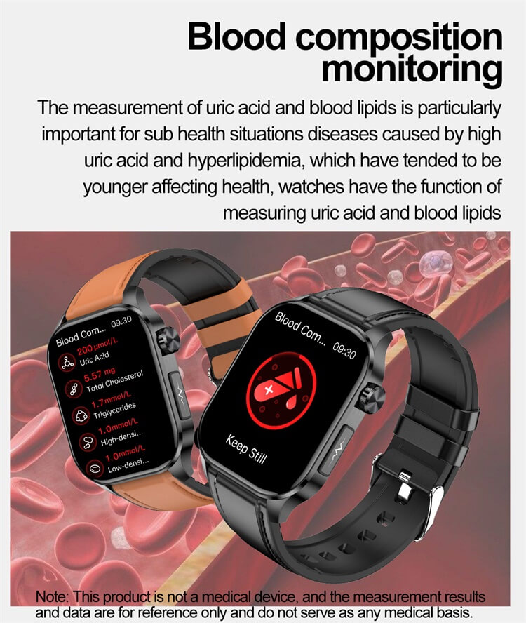 ET580 AMOLED okosóra EKG elektrokardiogram AI orvosi diagnosztika IP68 vízálló-Shenzhen Shengye Technology Co., Ltd.