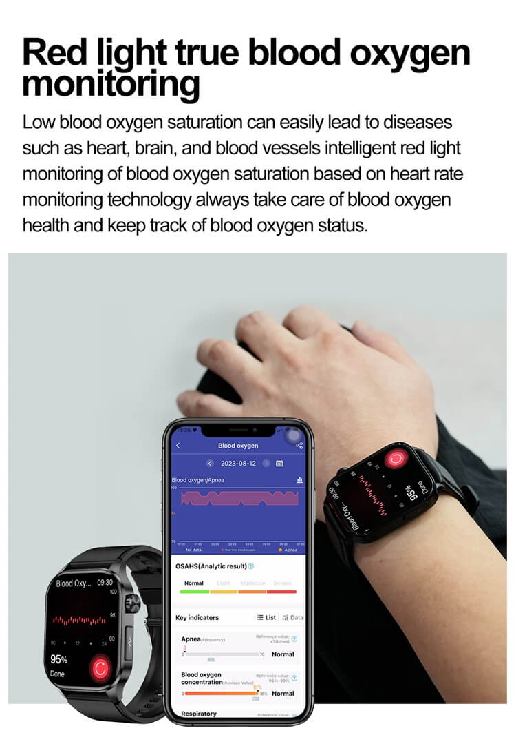 ET580 AMOLED Smartwatch ECG Elettrocardiogramma AI Diagnosi medica IP68 Impermeabile-Shenzhen Shengye Technology Co., Ltd