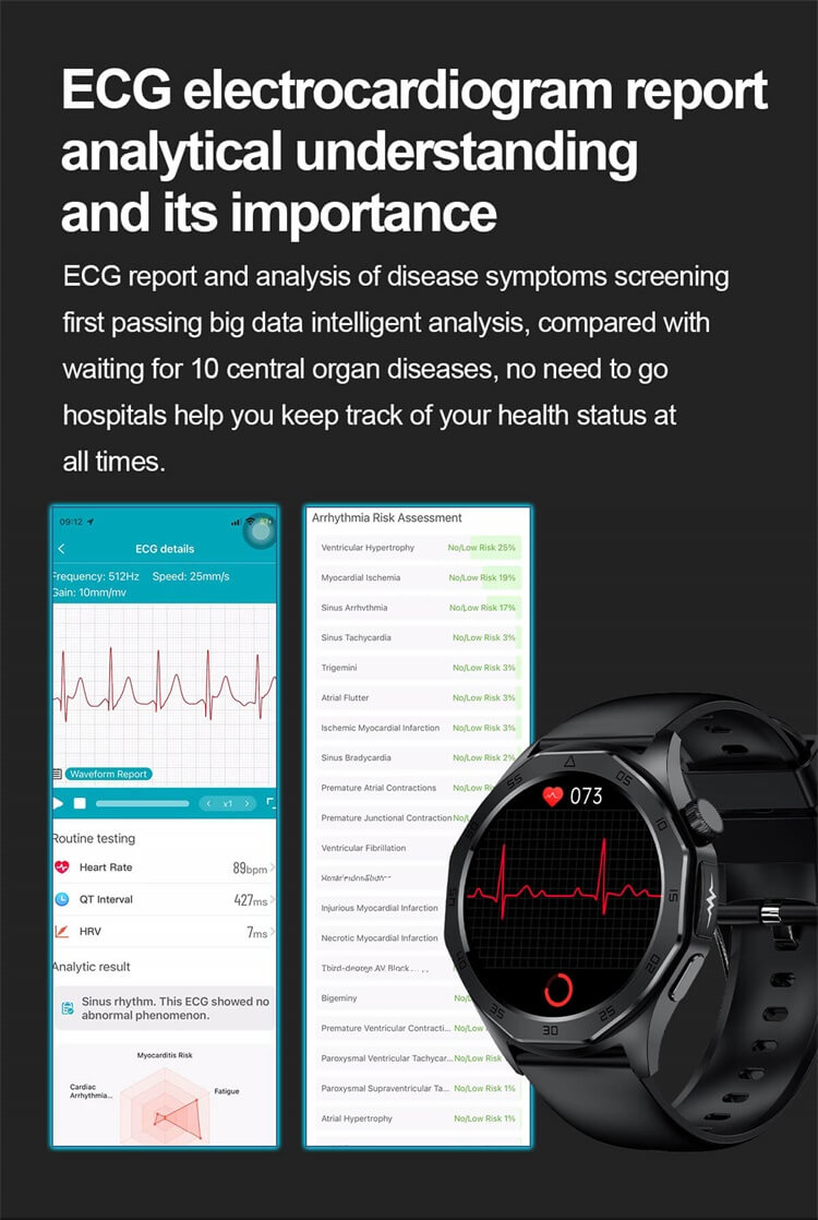 ET480 สมาร์ทวอทช์ AMOLED หน้าจอจอประสาทตาสูง ฟังก์ชั่นคลื่นไฟฟ้าหัวใจ ECG การตรวจสอบสุขภาพ - เซินเจิ้น Shengye Technology Co.,Ltd