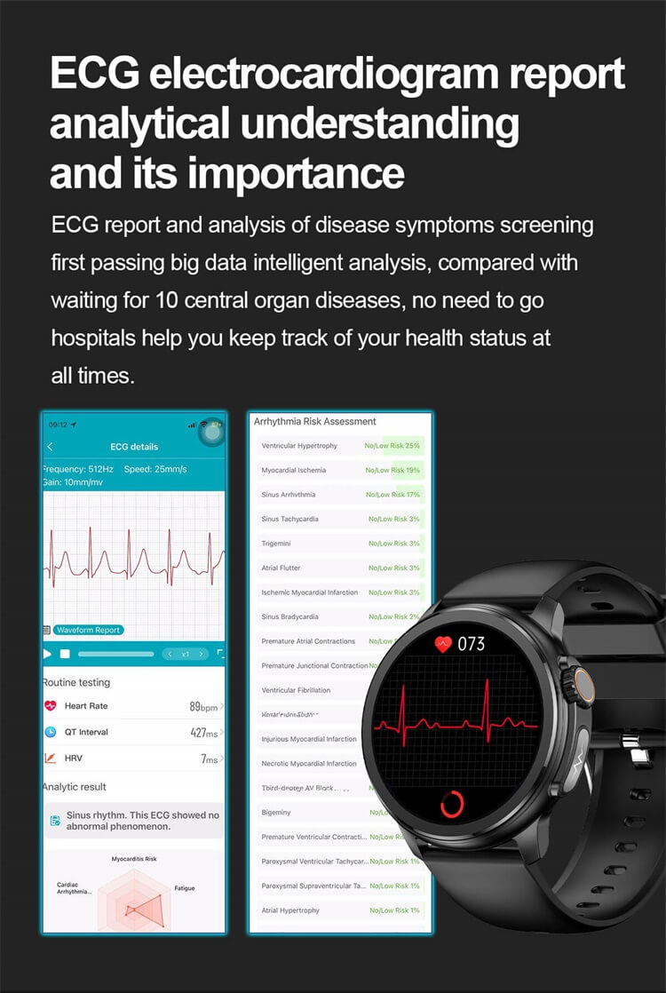 ET481 okosóra szívritmus-monitoring AMOLED képernyő, vércukorszint monitorozás – Shenzhen Shengye Technology Co., Ltd.