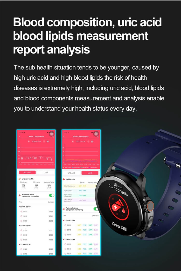 ET481 Smartwatch Monitoraggio del battito cardiaco Schermo AMOLED Monitoraggio della glicemia-Shenzhen Shengye Technology Co., Ltd