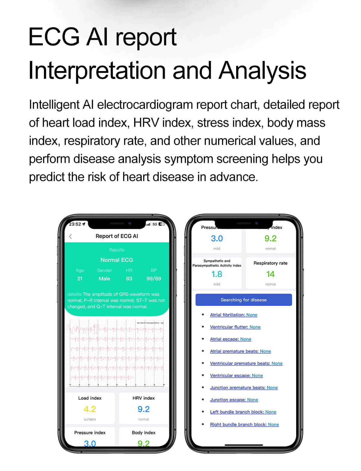 Έξυπνο ρολόι ET381 1,43 ιντσών AMOLED Screen ECG Testing Bluetooth Call Professional Fitness Monitoring-Shenzhen Shengye Technology Co.,Ltd