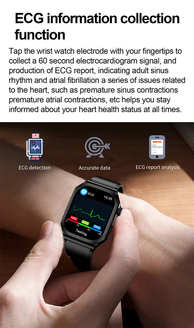 ET280 Smartwatch Eletrocardiograma Teste de Glicose no Sangue Monitoramento SOS Chamada de Emergência-Shenzhen Shengye Technology Co., Ltd