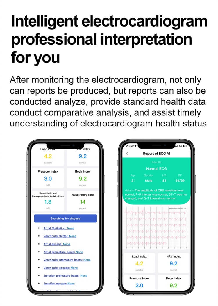 ET280 Smartwatch test d'électrocardiogramme surveillance de la glycémie appel d'urgence SOS-Shenzhen Shengye Technology Co., Ltd