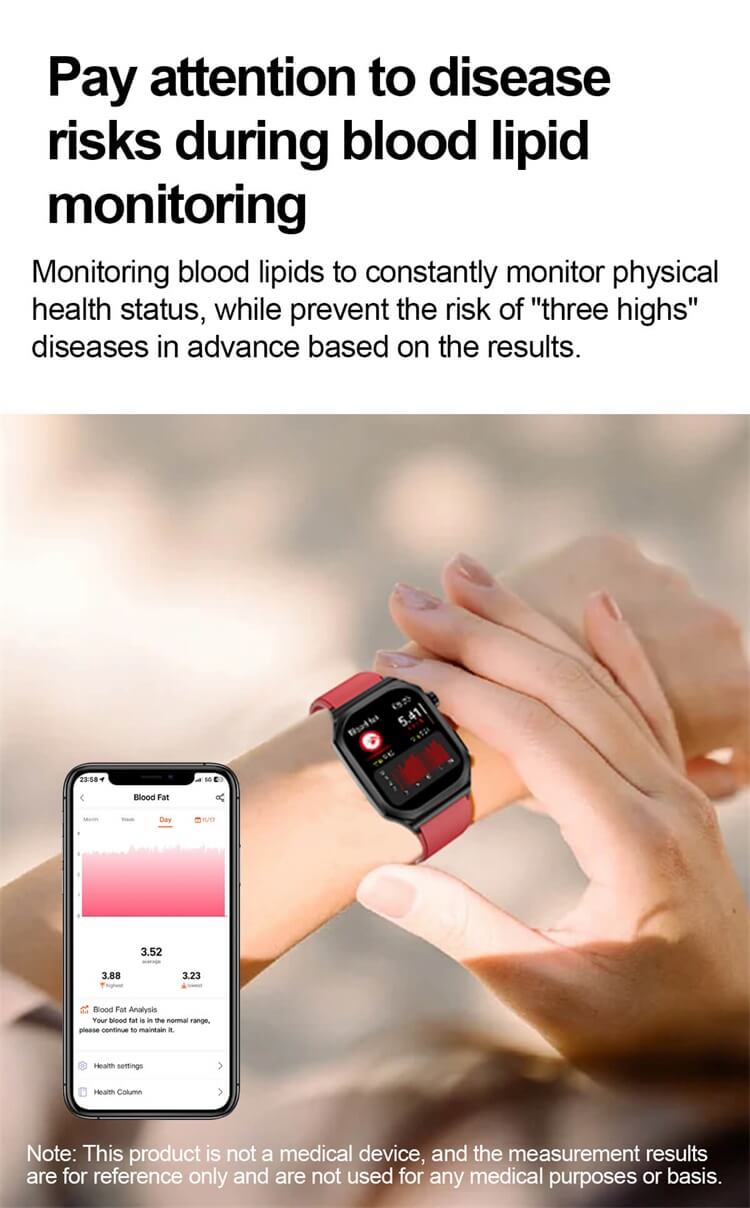 ET280 Smartwatch Elettrocardiogramma Test Monitoraggio della glicemia SOS Chiamata di emergenza-Shenzhen Shengye Technology Co., Ltd