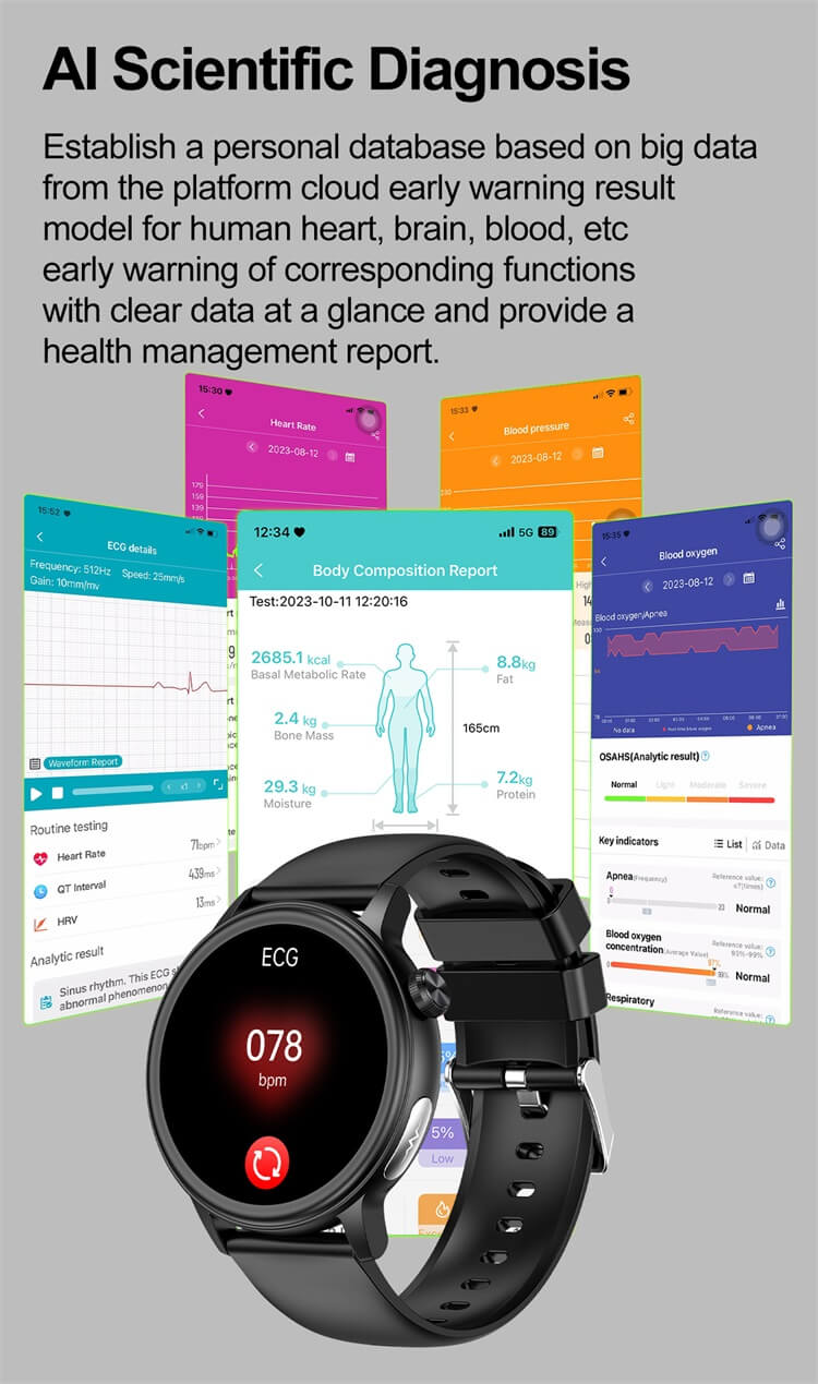 ET470 Smartwatch 1.39 pollici IPS Full Touch Screen ad alta definizione Monitoraggio elettrocardiogramma-Shenzhen Shengye Technology Co., Ltd