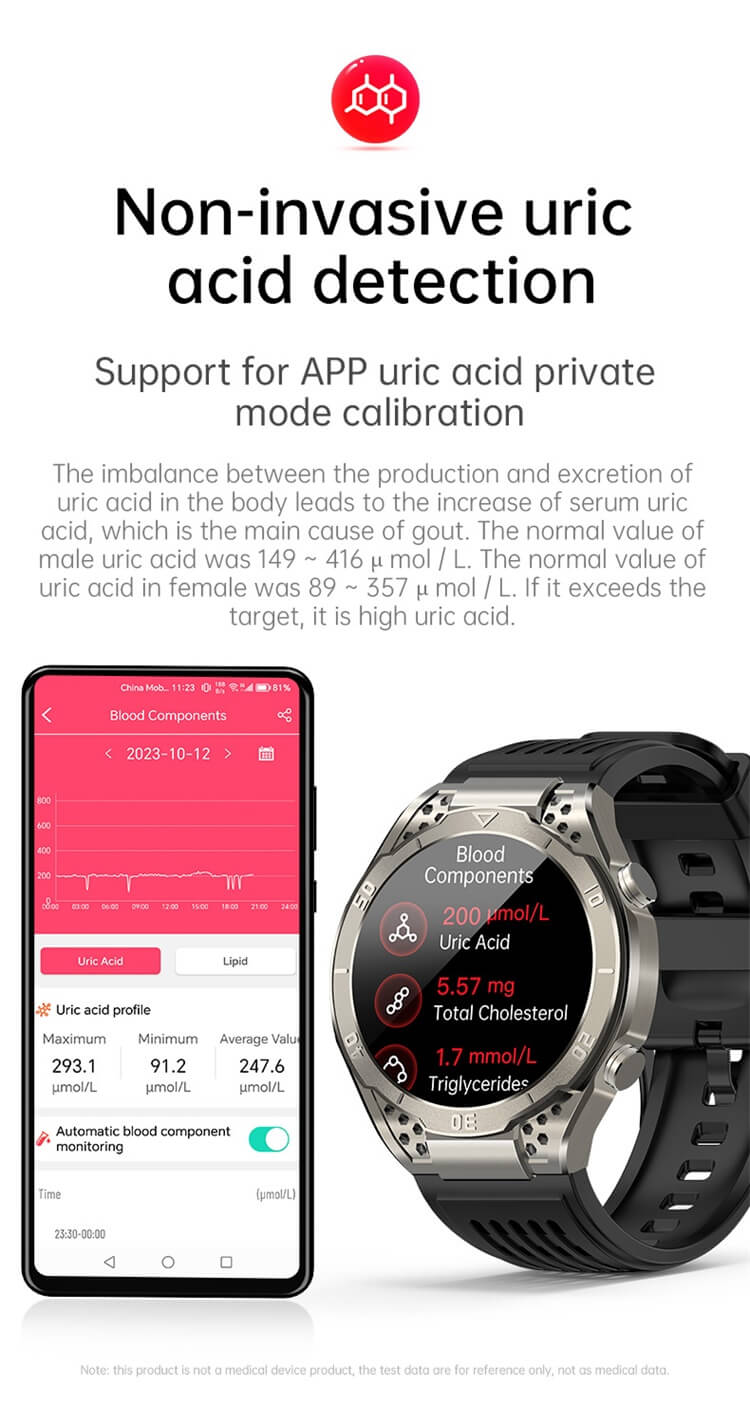 Smartwatch VE33 PRO Ekran o wysokiej rozdzielczości Badanie EKG Wykrywanie kwasu moczowego-Shenzhen Shengye Technology Co., Ltd