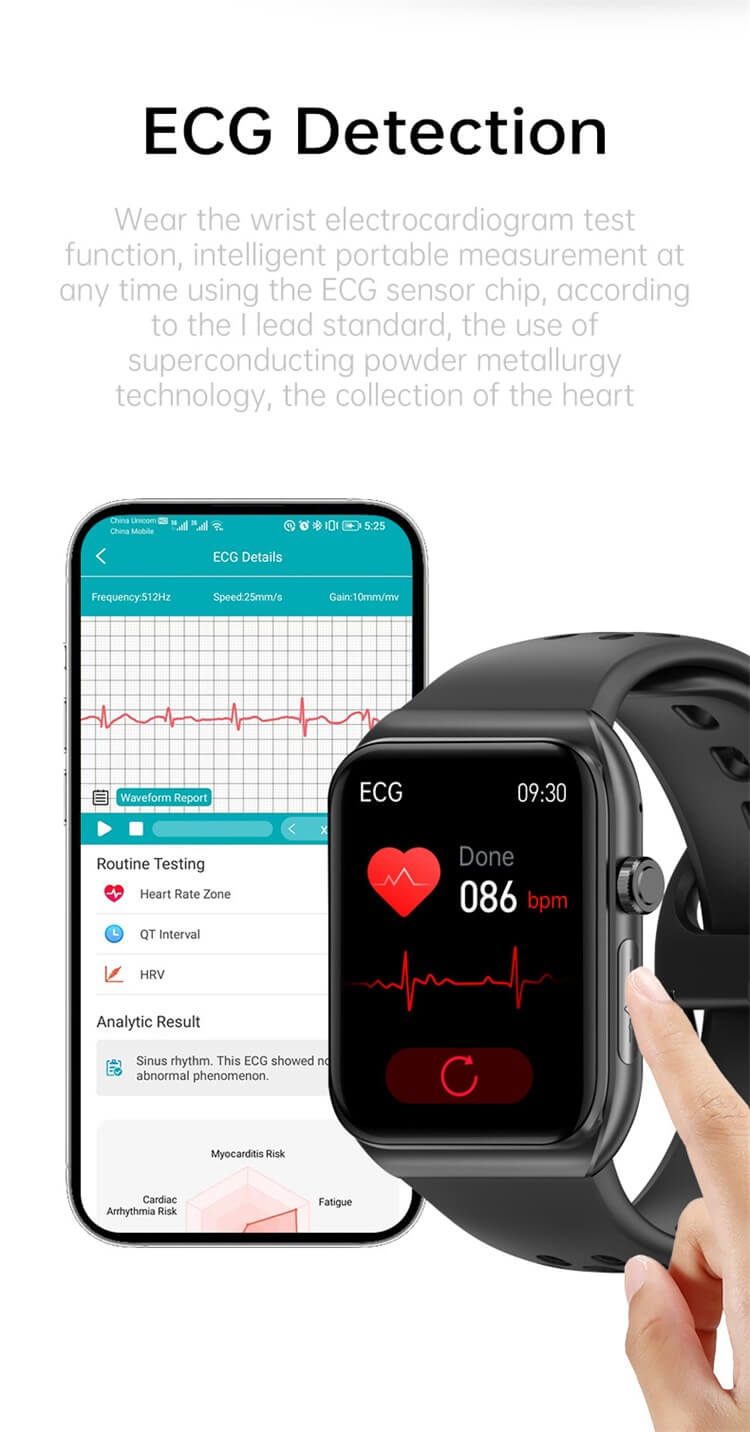 VE30 Smartwatch Monitoraggio dei lipidi nel sangue Modalità sportive multiple Durata della batteria lunga-Shenzhen Shengye Technology Co., Ltd