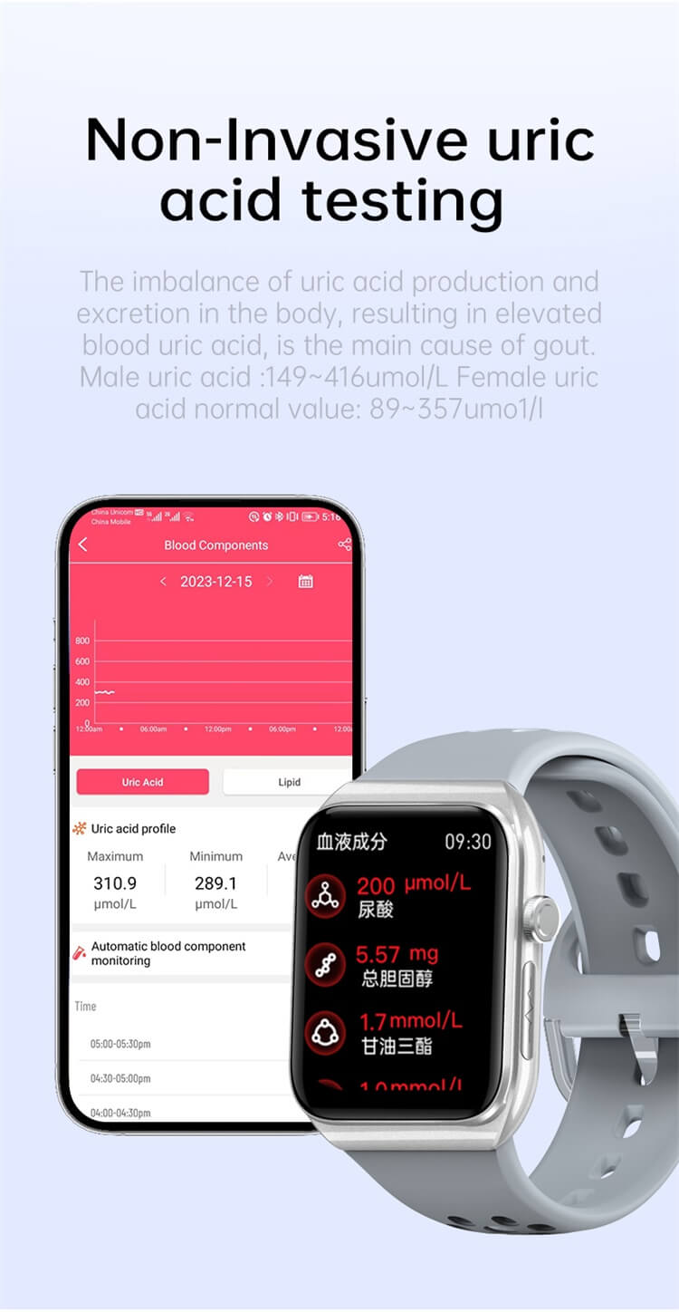 VE30 Smartwatch Monitoraggio dei lipidi nel sangue Modalità sportive multiple Durata della batteria lunga-Shenzhen Shengye Technology Co., Ltd