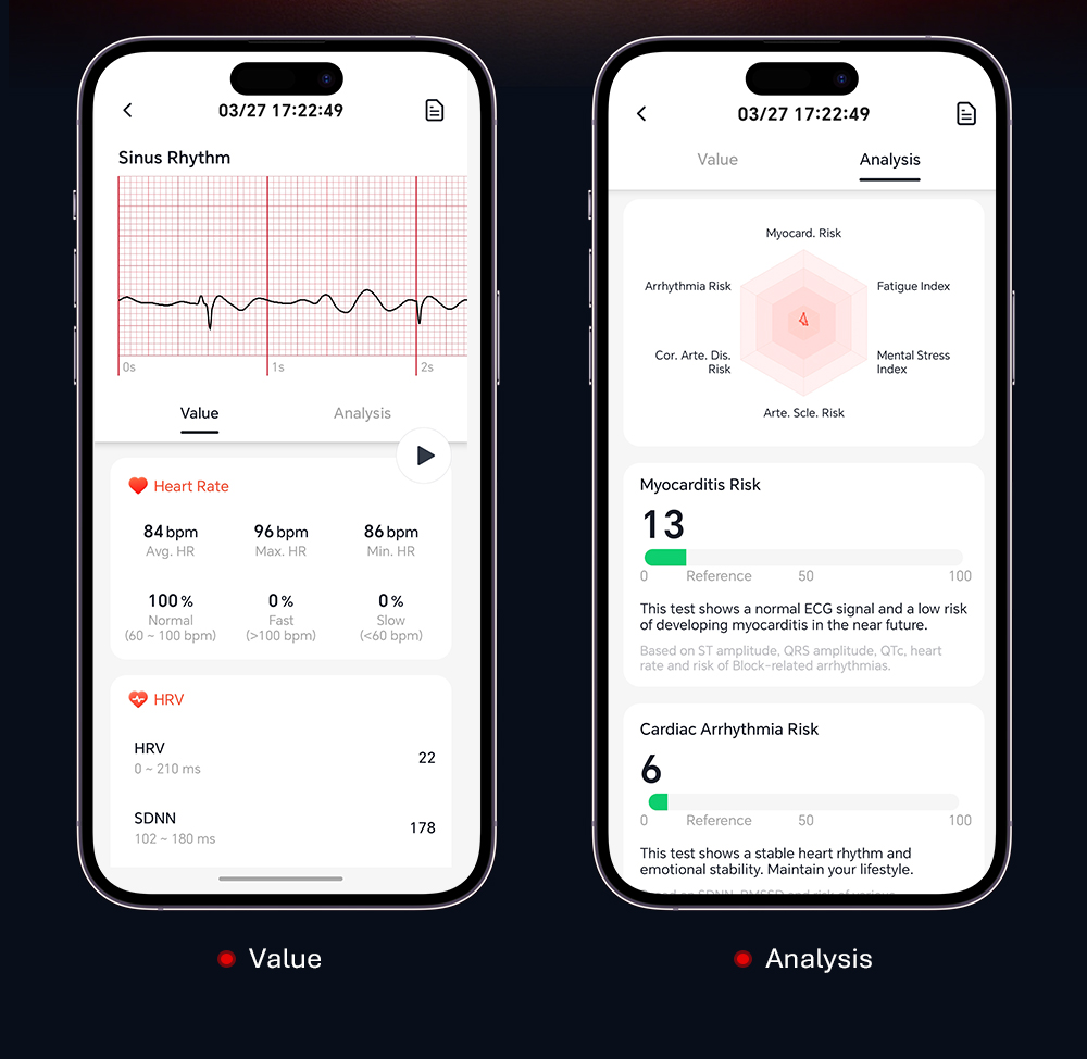 VALDUS VANTA New Screenless Smart Watch Supports ECG Monitoring Multiple Sports Modes Womens Health Reminder Screenless Smartwatch-Shenzhen Shengye Technology Co.,Ltd